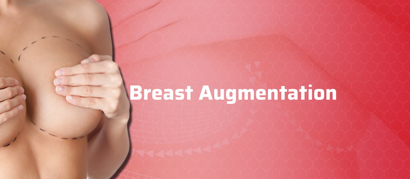 Breast Augmentation (Enlargement)