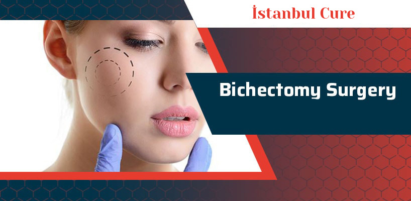 Bichectomy Surgery